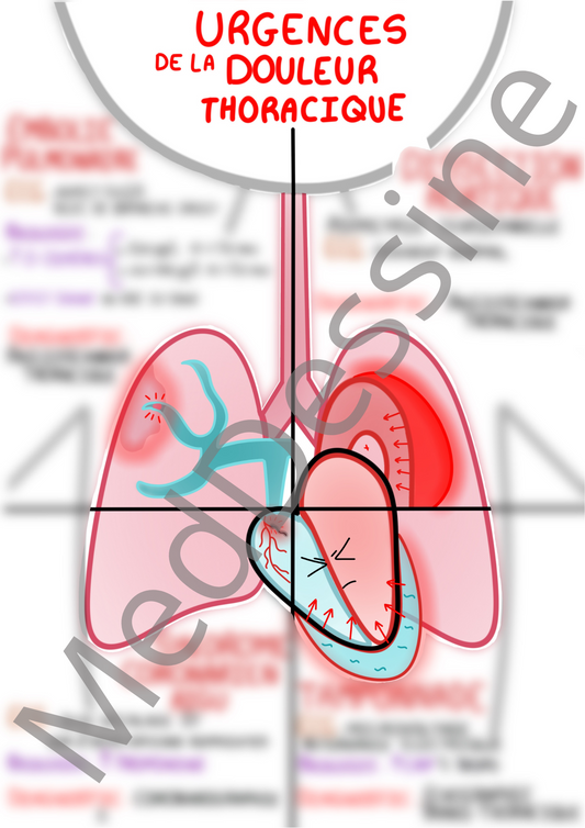 Urgences de la douleur thoracique