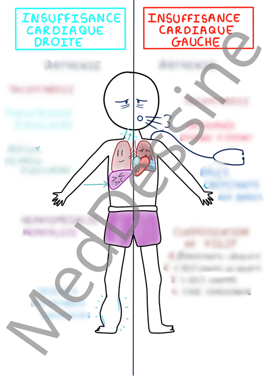 Insuffisance cardiaque